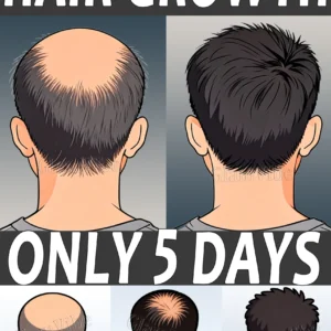 Herbal Hair Loss Treatment
