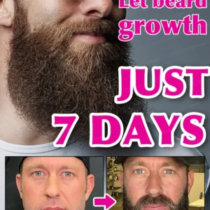 Beard Growth Essence (30ml)